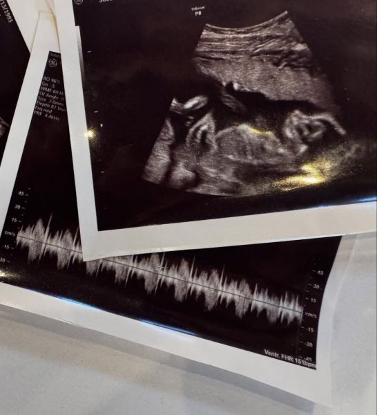 Звезда Disney Дебби Райан ждет первенца от барабанщика Twenty One Pilots